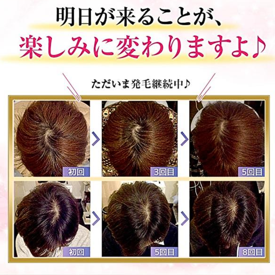 ＥｌｅＭｏｉ エレモア 育毛液ＢＬボーテ／医薬部外品（１５０ｍｌ）