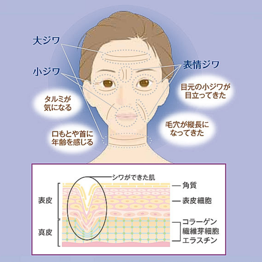 ラシンシア アクアゲル プラチナム ＢＴＸセラム（３０ｍｌ）ＰＴナノコロイド配合リンクル美容液