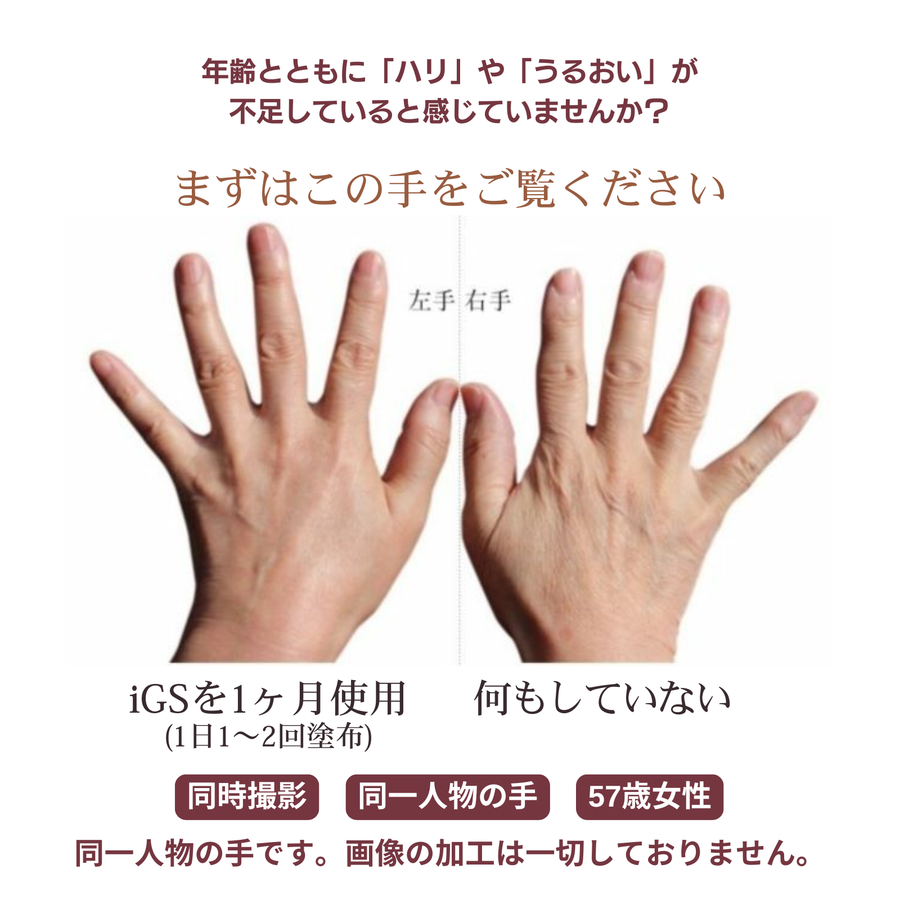 ｉＧＳ４０００Ｇｅｌ ジェル （１００ｇ） 特許成分 瞬芽ブドウ種子エキス成分配合