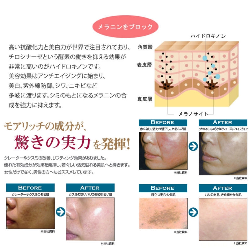 Ｍｏｒｅ　Ｒｉｃｈ／モアリッチ　ハイドロトーン（５０ｇ）#美肌高濃度クリーム ハイドロキノン トーン 透明感 なめらか 明るい シミ 色素 メラニン ブライトニング フラーレン ドクターシューティカル
